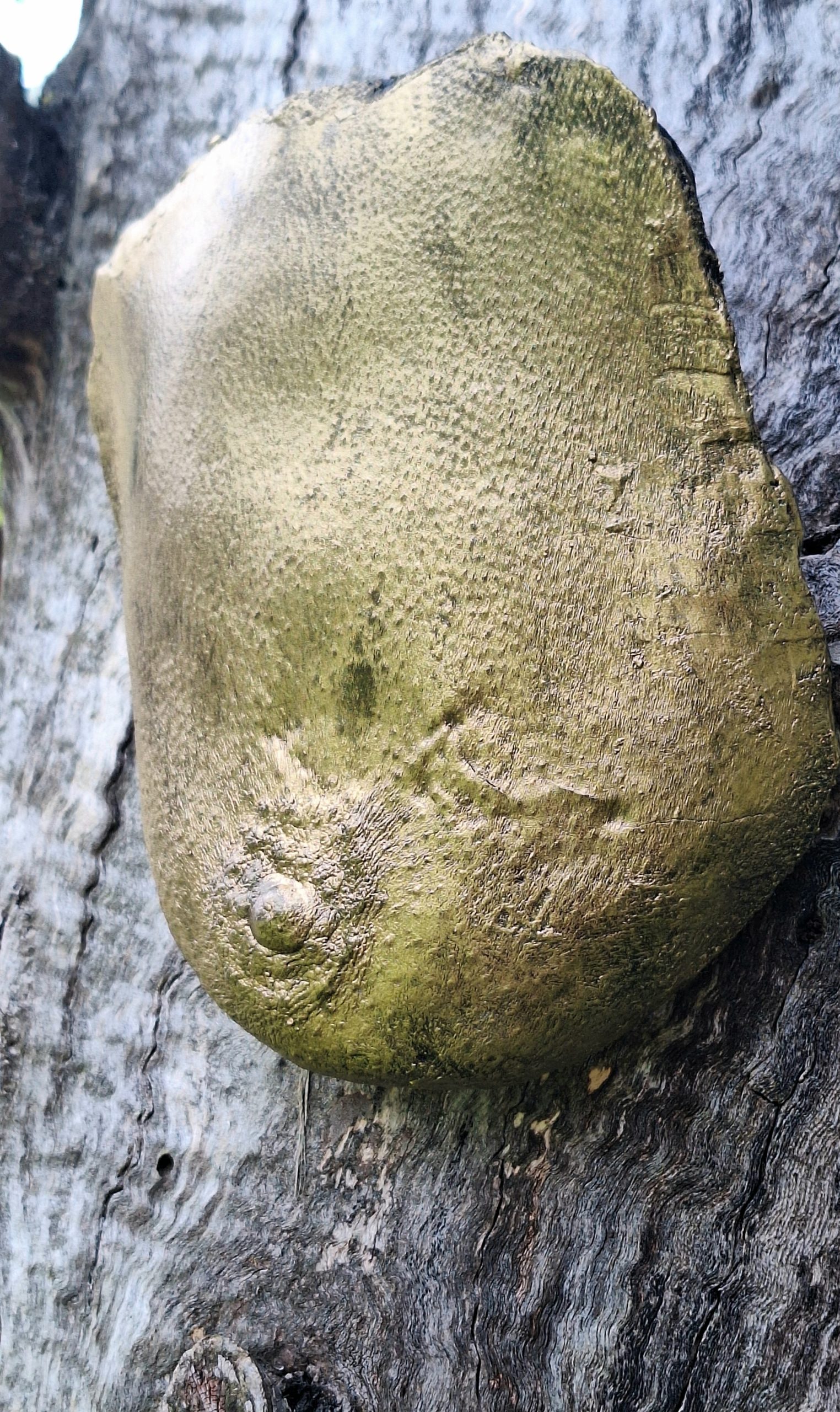 moulage de seins d'une femme ayant souhaité conserver un souvenir de sa poitrine avant une mastectomie, célébrant la mémoire et la résilience